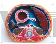 The model of abdominal cavity transection